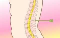 干細(xì)胞移植治療脊損傷效果明顯