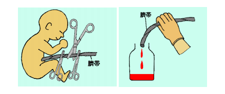 臍帶血造血干細(xì)胞的采取方法